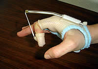 Orth&egrave;ses courantes